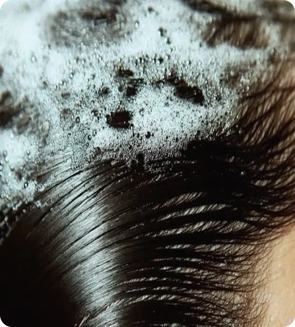 Close-up of a person with black hair covered in white foam, likely from a shampoo or scalp treatment.
